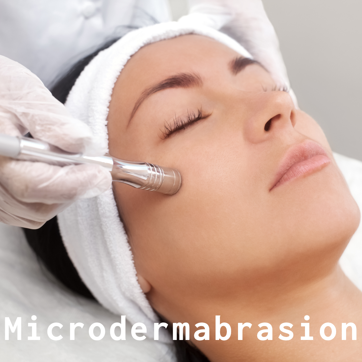 Microdermabrasion