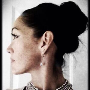 First signs of Melasma